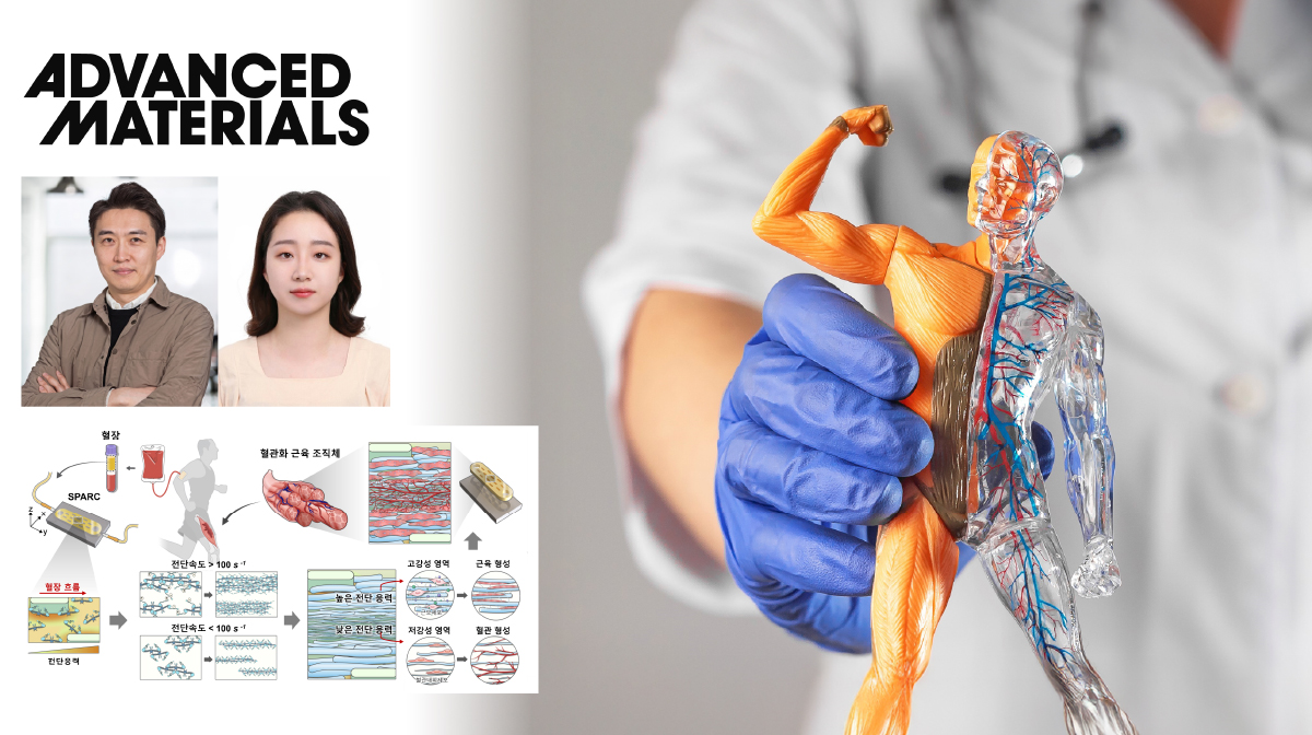 자가혈액으로 만드는 ‘맞춤형 근육-혈관’…  난치성 근육 손상 치료 새 지평